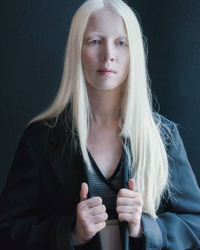 Kenalan Yuk Sama Bera, Cowok Albino yang Bikin Kamu Berdecak Kagum. Selain Doi, 5 Model Ini Tak Kalah Memesona