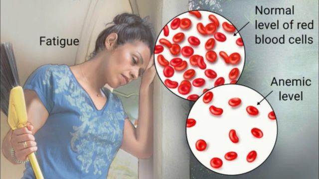 5 Bahaya Minum Teh Setelah Makan. Segar Memang, tapi Bawa Kerugian