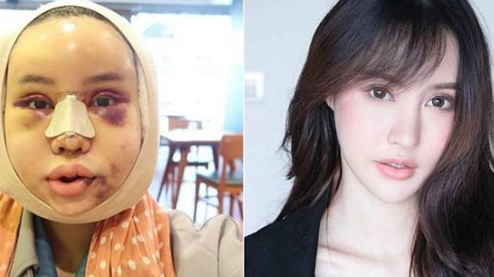 Tidak Ada Salahnya Untuk Menghargai Pilihan Mereka Tentang Standar Kesempurnaan.