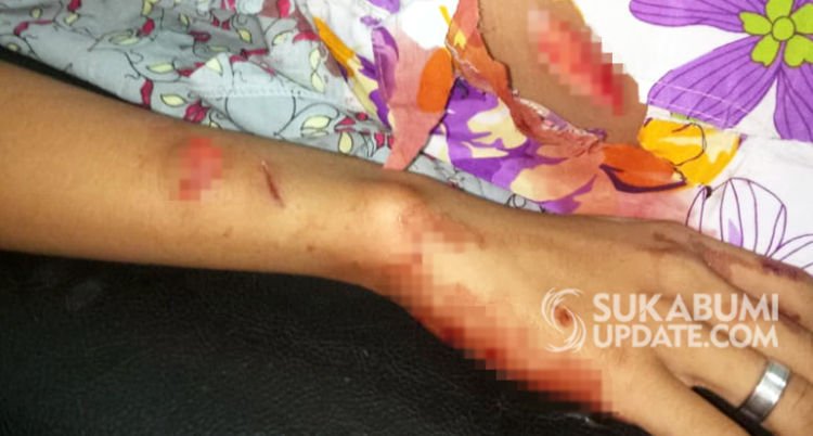 Siswa Dibacok Temannya Sendiri di Sukabumi. Mirisnya, Kejadian Ini Terjadi di Dalam Kelas Lo