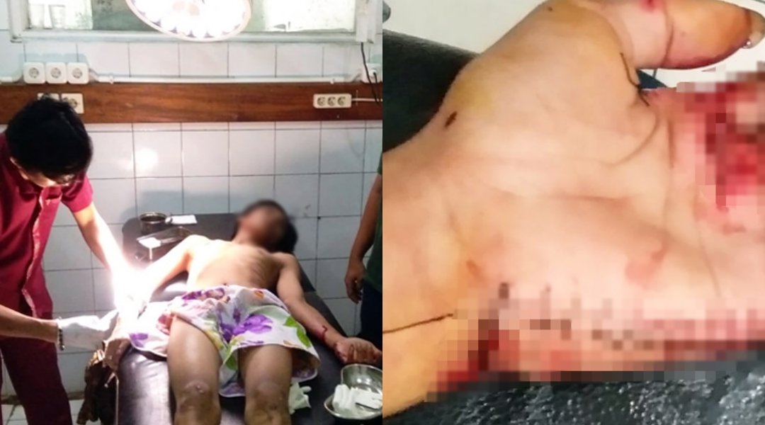 Siswa Dibacok Temannya Sendiri di Sukabumi. Mirisnya, Kejadian Ini Terjadi di Dalam Kelas Lo
