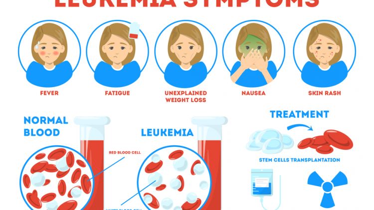 6 Info Tentang Kanker Darah yang Simpang Siur. Kanker Darah = Leukimia?