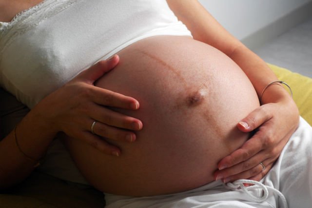 4 Fakta di Balik Linea Nigra, Garis Hitam yang di Perut Para Ibu Hamil. Normal Nggak Ya?