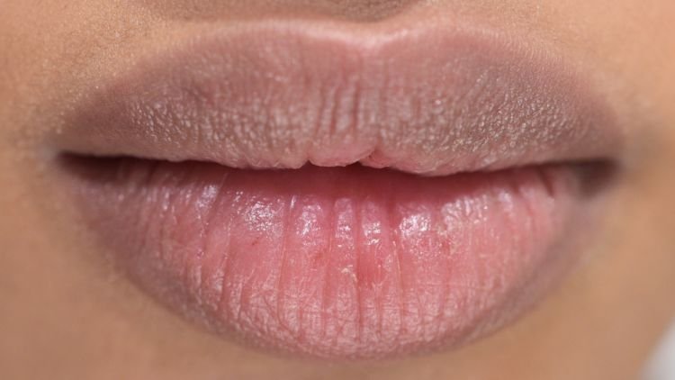 5 Penyebab Tak Terduga Kenapa Bibirmu Jadi Hitam Selain Merokok