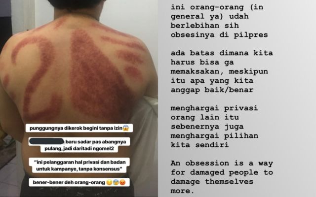 Dikerokin Tukang Urut, Punggung Pria ini Diarsir Nomor Urut Capres. Kocak, Dikira Baliho Kali~