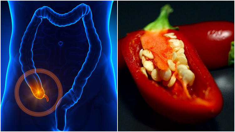 7 Fakta Tentang Gejala Usus Buntu yang Menyesatkan. Biji Jambu atau Cabai Tak Ada Hubungannya