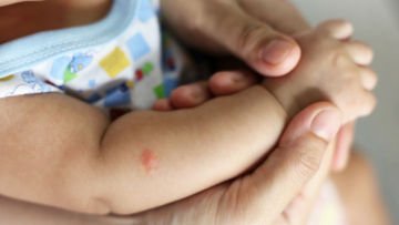 Bukan Cuma Serai, Ini 11 Bahan Alami yang Ampuh Basmi Nyamuk dan Aman Bagi Bayi
