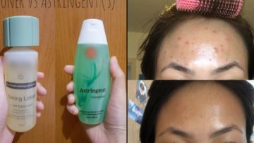 Perbedaan Toner dan Astringent dari Kandungan dan Penggunaannya