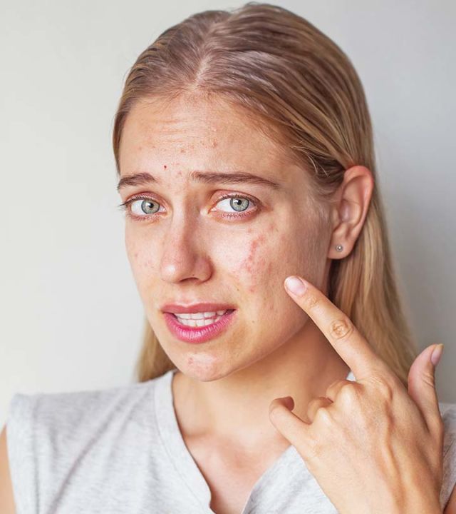 5 Tanda Sabun Muka Tidak Cocok yang Perlu Diketahui 11 Tanda Sabun Muka Tidak Cocok