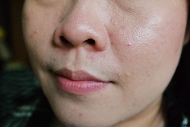 5 Tanda Sabun Muka Tidak Cocok yang Perlu Diketahui 14 Tanda Sabun Muka Tidak Cocok