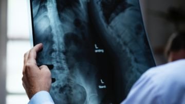 5 Fakta Menarik Jurusan Radiologi. Ditakuti dan Jarang Peminat tapi Lulusannya Banyak Dibutuhkan