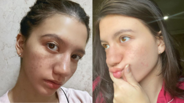 Unggah Foto Wajah Penuh Freckles, Cassandra Lee Bicara Soal Menyayangi Diri Sendiri