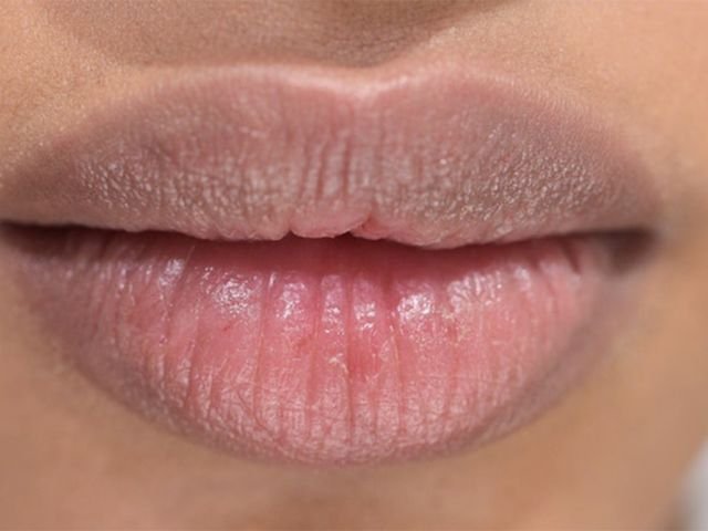 manfaat madu untuk bibir