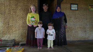 10 Potret Kehidupan Keluarga Albino di Desa Ciburuy, Jawa Barat. Rentan Di-bully karena Berbeda