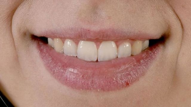 manfaat madu untuk bibir