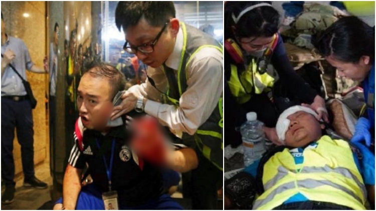 5 Tragedi Berdarah dalam Demo di Hong Kong. Ada yang Ditusuk & Digigit Telinganya Terang-terangan