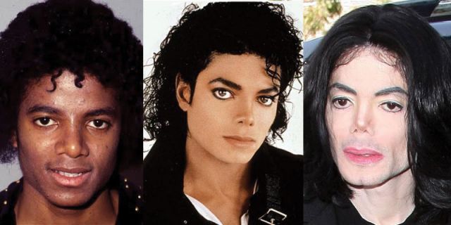 Michael Jackson Sebelum dan Sesudah Operasi
