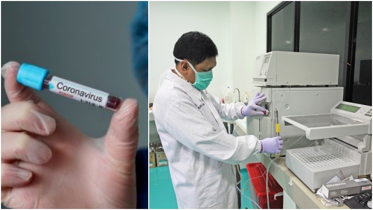 Belum Ada Pasien Terjangkit, Ahli Medis Ragukan Pemeriksaan Virus Corona di Indonesia