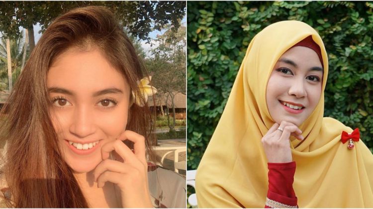 Tetap Pede Bahkan Kelihatan Lebih Manis, Ini Dia 8 Artis yang Bergigi Gingsul. Senyumnya itu loh~