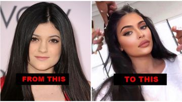 Ini Alasan Kenapa Bibir Tebal Ala Kylie Jenner Banyak Diidamkan. Apa Kabar Nih Bibir Tipis?