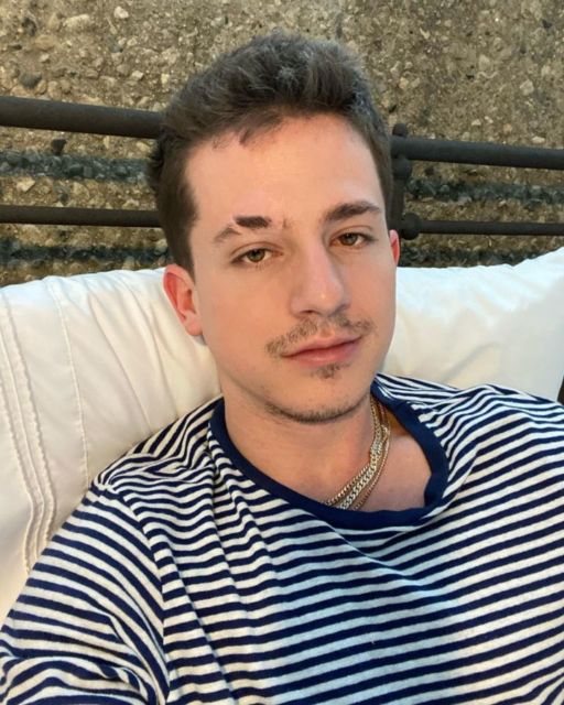 Bekas Luka di Wajah para Artis ini Bikin Penasaran, Ada Ceritanya di Baliknya