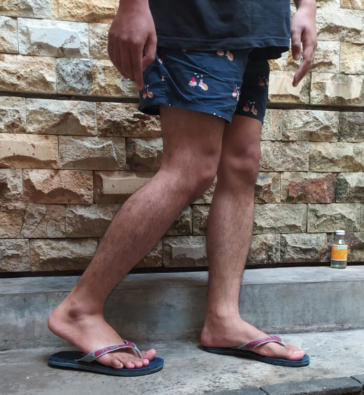 10 Posisi Kaki Saat Foto yang Pernah Ngetren pada Zaman Alay. Nyesel Nggak sih Sempat Begini? :(
