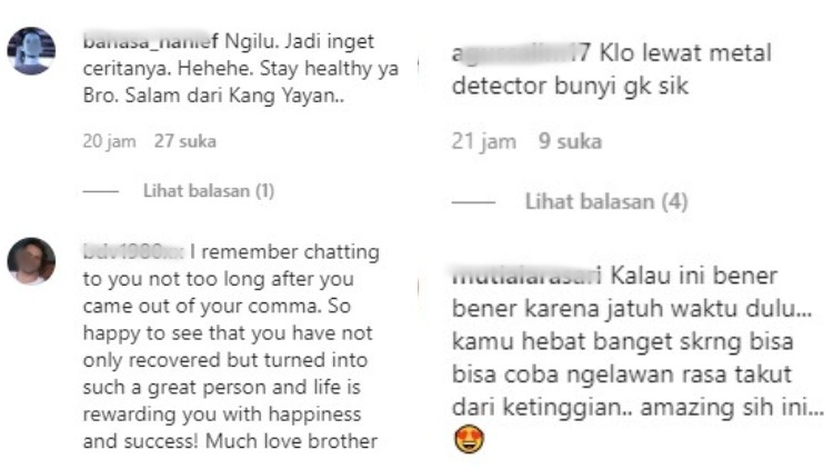 Sempat Trauma karena Kecelakaan, Hamish Daud Unggah Foto X-Ray Wajahnya. Ternyata Penuh Baut