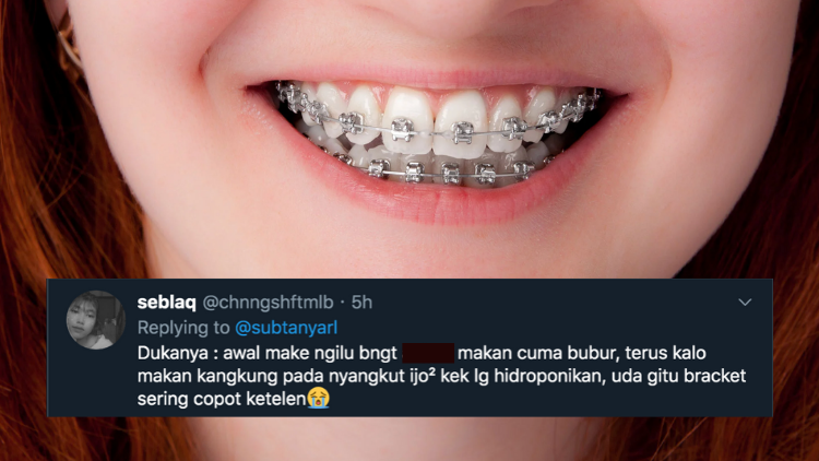 Suka Duka bagi Orang-Orang yang Pakai Behel. Jangan Kira Kawat Gigi Bisa Bikin Auto Cakep, Ya!