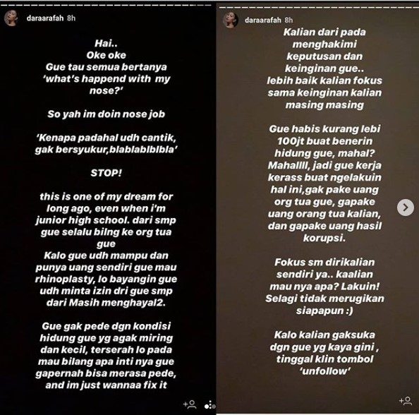 Dicecar Soal Operasi Hidung, Dara Arafah: Udah Minta Izin Orang Tua Sejak SMP