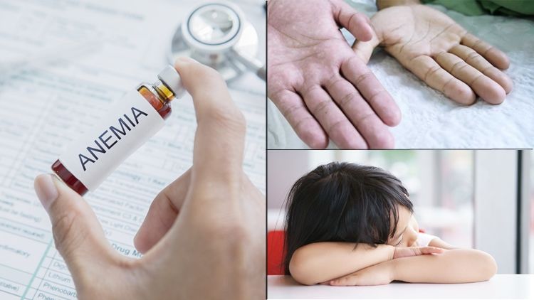 Macam-macam Gejala Anemia, Demen Ngunyah Es Batu Salah Satunya. Kamunya Aja yang Nggak Sadar
