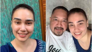 Lakukan Kemoterapi, Feby Febiola Pede dengan Rambut Cepak. Franky Sihombing Beri Pesan Romantis