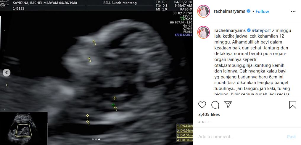 Hampir 9 Tahun Menikah Siri, ini Alasan Rachel Maryam Baru Ajukan Isbat Pernikahan Sekarang