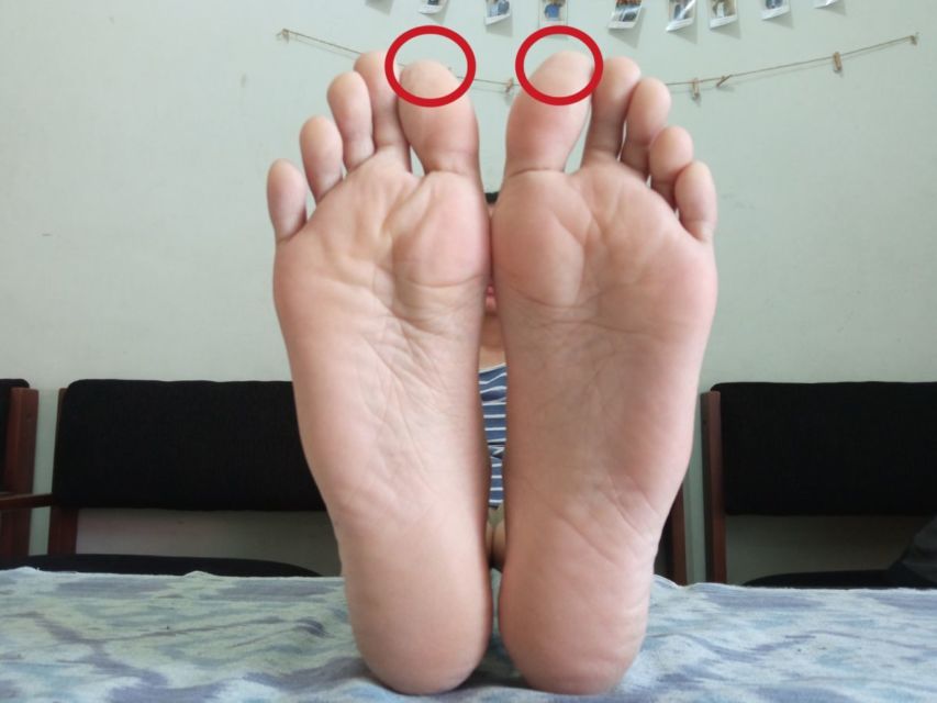titik akupuntur kaki