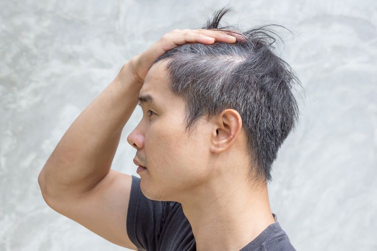 7 Mitos dan Fakta Tentang Rambut Uban. Memangnya Kalau Dicabut, Tumbuhnya Jadi Banyakan?
