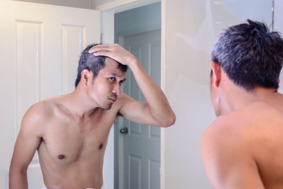 7 Mitos dan Fakta Tentang Rambut Uban. Memangnya Kalau Dicabut, Tumbuhnya Jadi Banyakan?