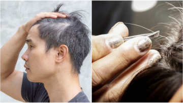 7 Mitos dan Fakta Tentang Rambut Uban. Memangnya Kalau Dicabut, Tumbuhnya Jadi Banyakan?