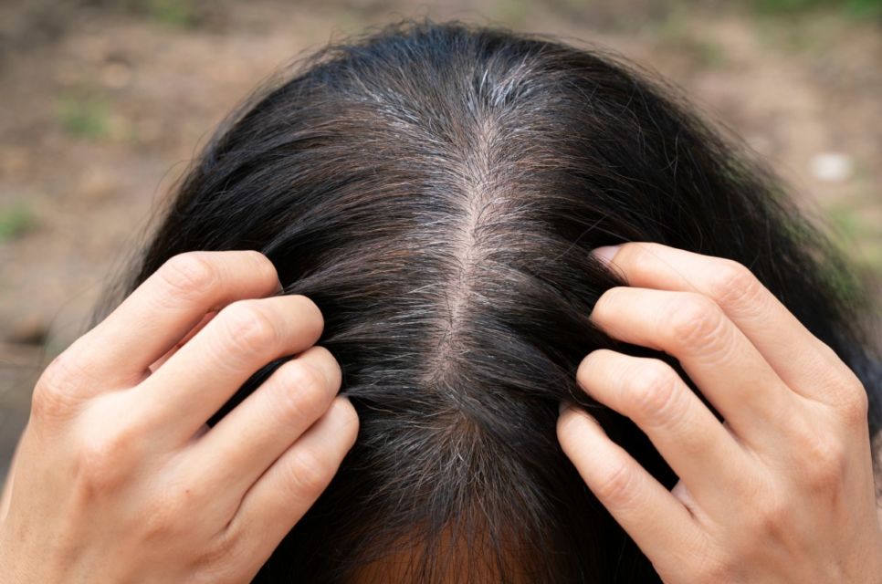 7 Mitos dan Fakta Tentang Rambut Uban. Memangnya Kalau Dicabut, Tumbuhnya Jadi Banyakan?