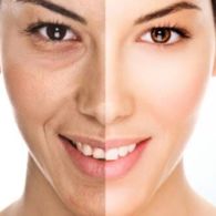 Ternyata Ini Nggak Cuma Masalah Skincare Lho, Berikut 5 Tips Agar Kulit Wajahmu Selalu Sehat