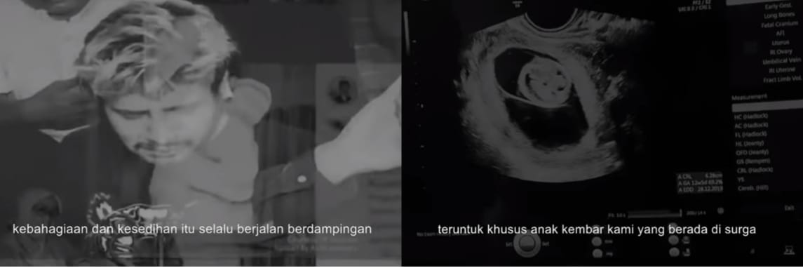 Kenang Setahun Kepergian Bayi Kembarnya, Ammar Zoni: Semoga Bertemu dan Bersama di Surga Nanti