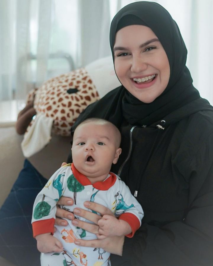 Terkenal karena Gigi Gingsulnya yang Bikin Makin Manis, Irish Bella Pilih Hilangkan Ciri Khasnya itu