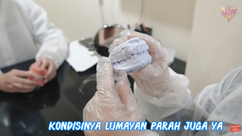 Terkenal karena Gigi Gingsulnya yang Bikin Makin Manis, Irish Bella Pilih Hilangkan Ciri Khasnya itu