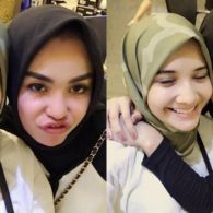 Kini Berdamai dengan Zaskia Sungkar, Medina Zein Anggap Perseteruannya sebagai Proses Pendewasaan