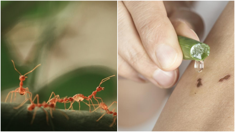 8 Bahan Alami untuk Redakan Gigitan Semut Rangrang yang Bikin Kulit Melepuh. Lumayan Ampuh!