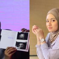 Pendarahan Berujung Keguguran, Nathalie Holscher Berusaha Semangat Meski Takut Mengecewakan