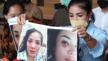 Beberkan Bukti KDRT yang Dilakukan Suami, Nindy Ayunda Menangis: Anak-anak dan Mendiang Ayah Tahu