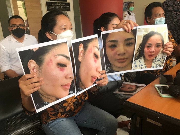 Beberkan Bukti KDRT yang Dilakukan Suami, Nindy Ayunda Menangis: Anak-anak dan Mendiang Ayah Tahu
