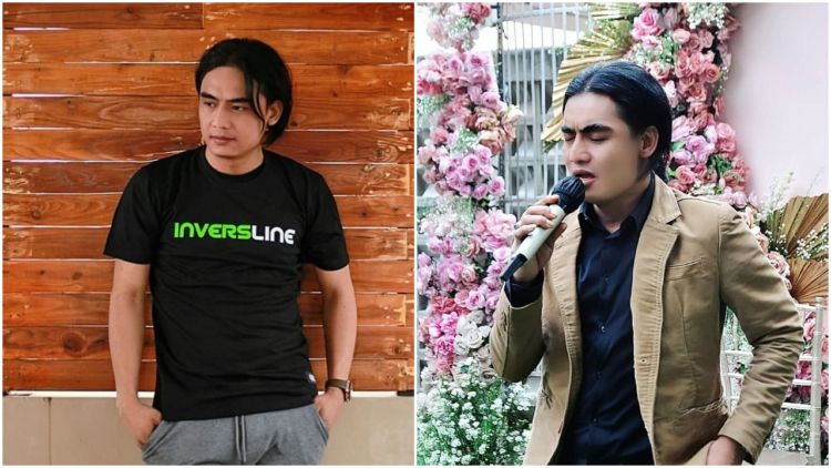 Jadi Salah Satu Artis yang Punya Rambut Khas, Charly Van Houten Merasa Tersiksa: Aku Ingin Kekinian