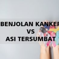 5 Cara Membedakan Benjolan Kanker dan ASI yang Tersumbat. Yuk, Pahami Sejak Dini!