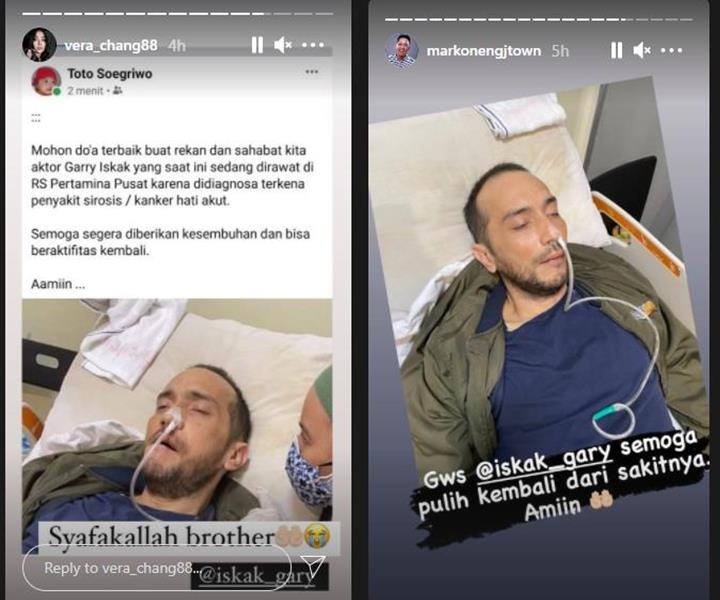 Gary Iskak Dikabarkan Idap Kanker Hati hingga Harus Dirawat di RS, Istri Ungkap Kondisi Terkini