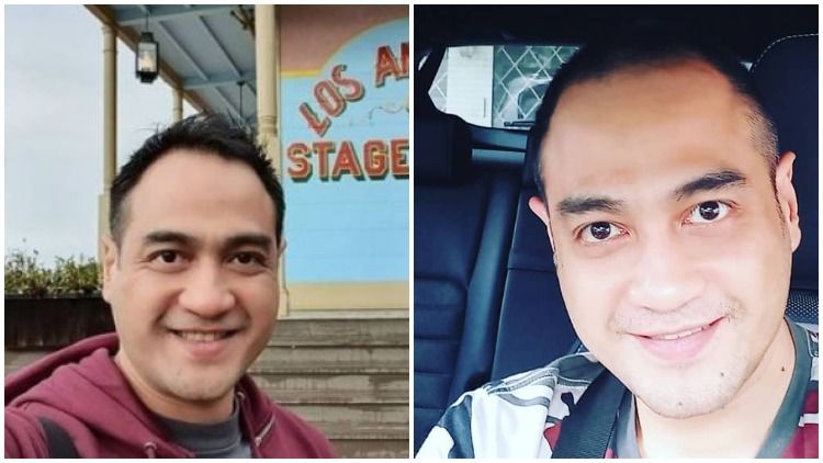 Aktor Lawas Ferry Irawan Alami Pecah Pembuluh Darah, Rekan Sesama Artis Galang Donasi